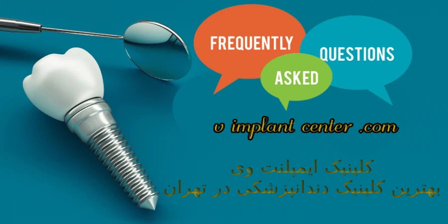 سوالات متداول درباره بهترین دکتر ایمپلنت در تهران