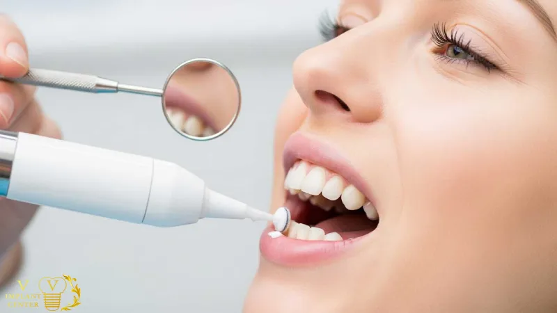 بروساژ دندان چیست و چه کاربردی دارد؟
