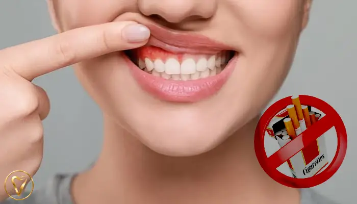 مهم‌ترین علت‌های تحلیل لثه چیست؟