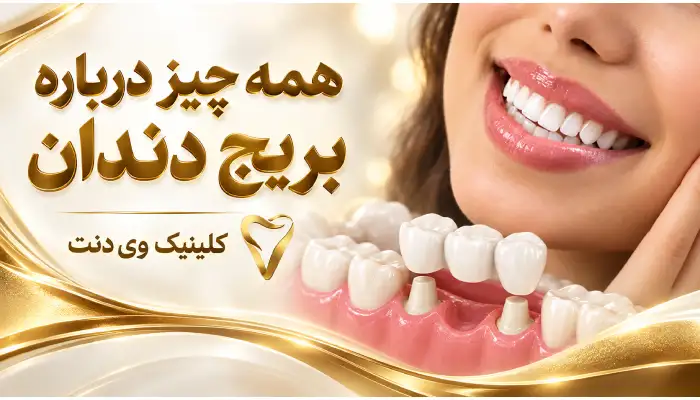 بریج دندان- کلینیک وی دنت
