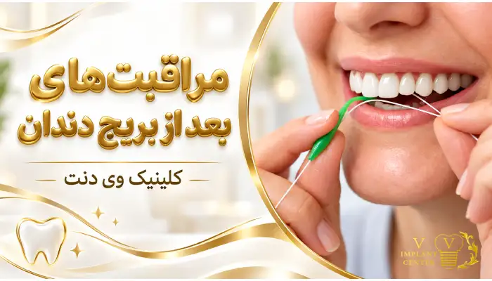 مراقبت های بعد از بریج دندان و نظافت زیر بریج