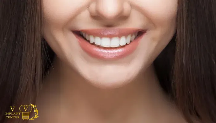چگونه طول عمر کامپوزیت دندان را بیشتر کنیم؟